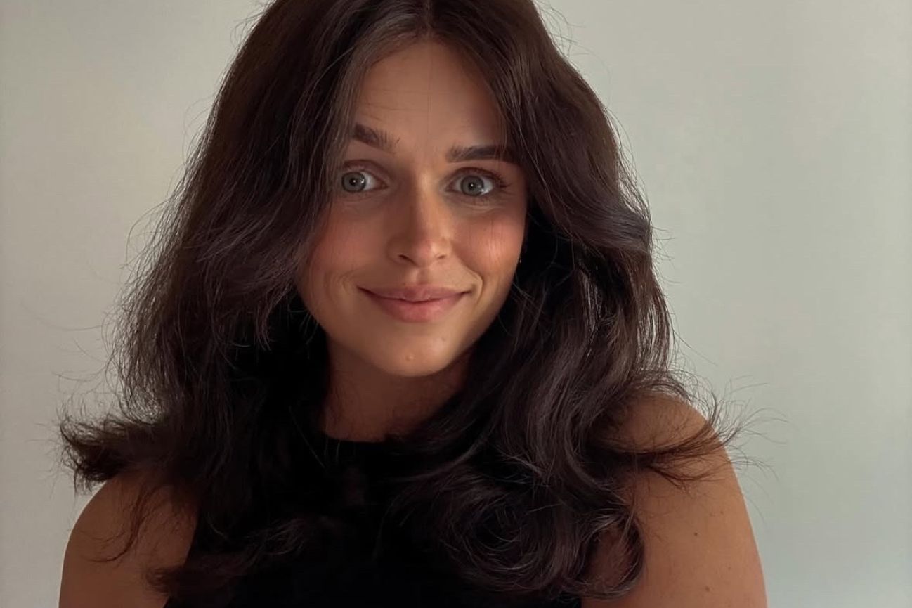 Ellie Rhodes: My Hair Loss Journey