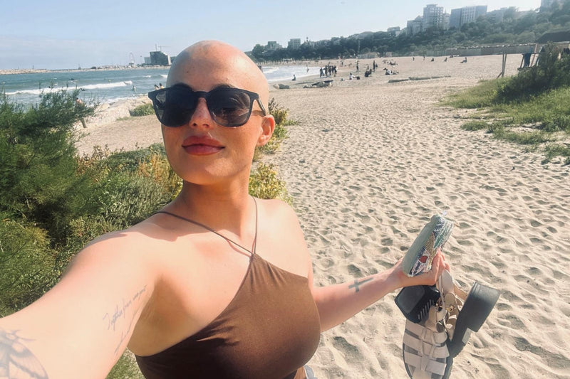 Alopecia Awareness Month | Emma's Hair Loss Journey