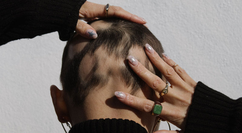 Mimi Drew: My Hair Loss Journey