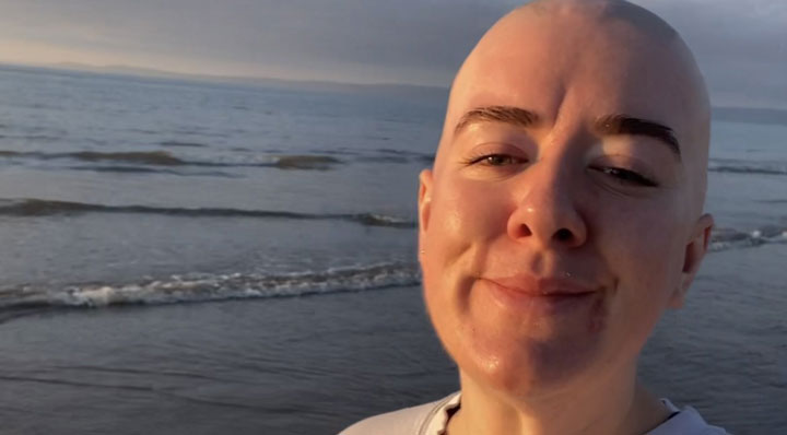 Nicole Thomas: My Hair Loss Journey