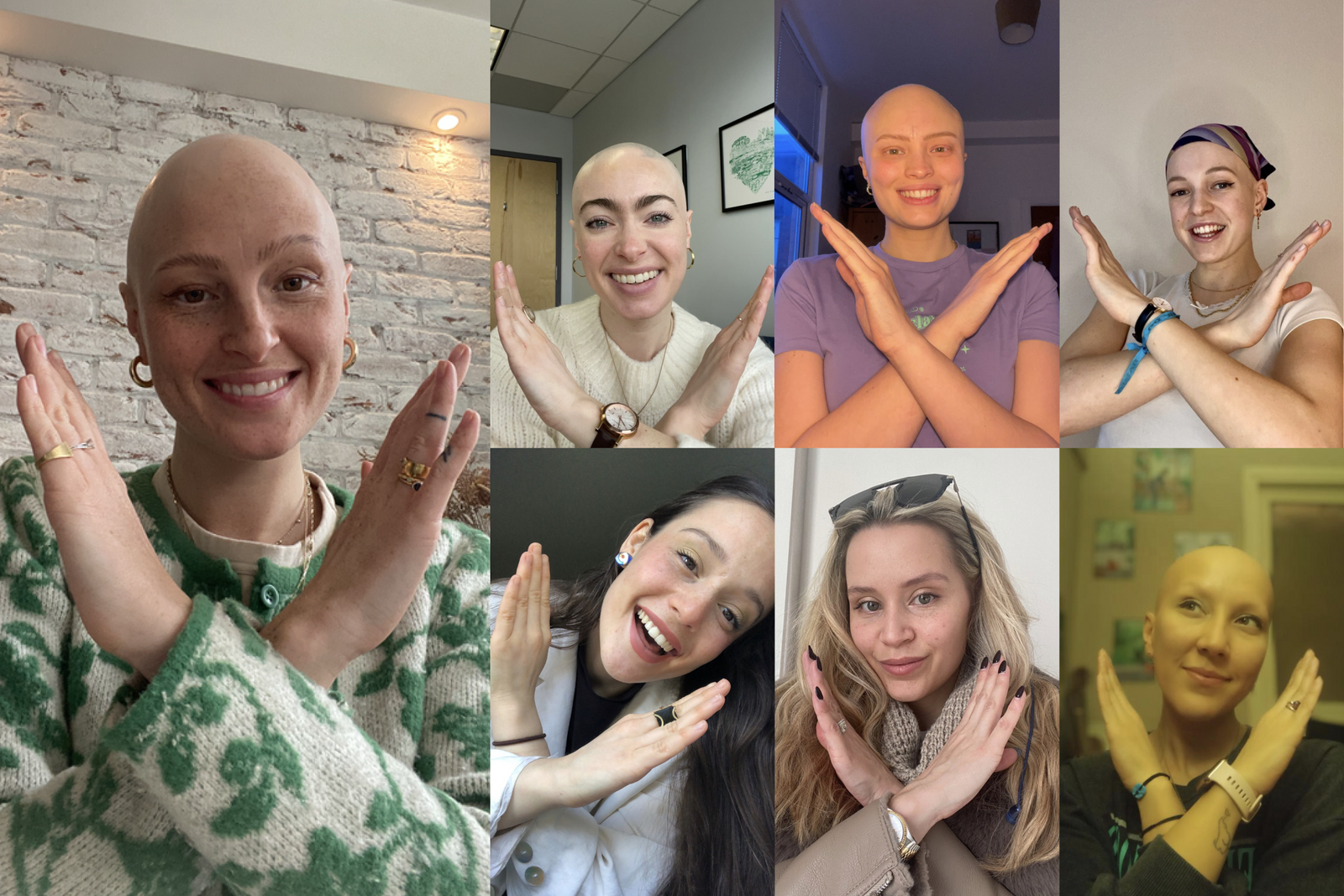 Wigs – Why I’m Breaking the Bias on International Women’s Day